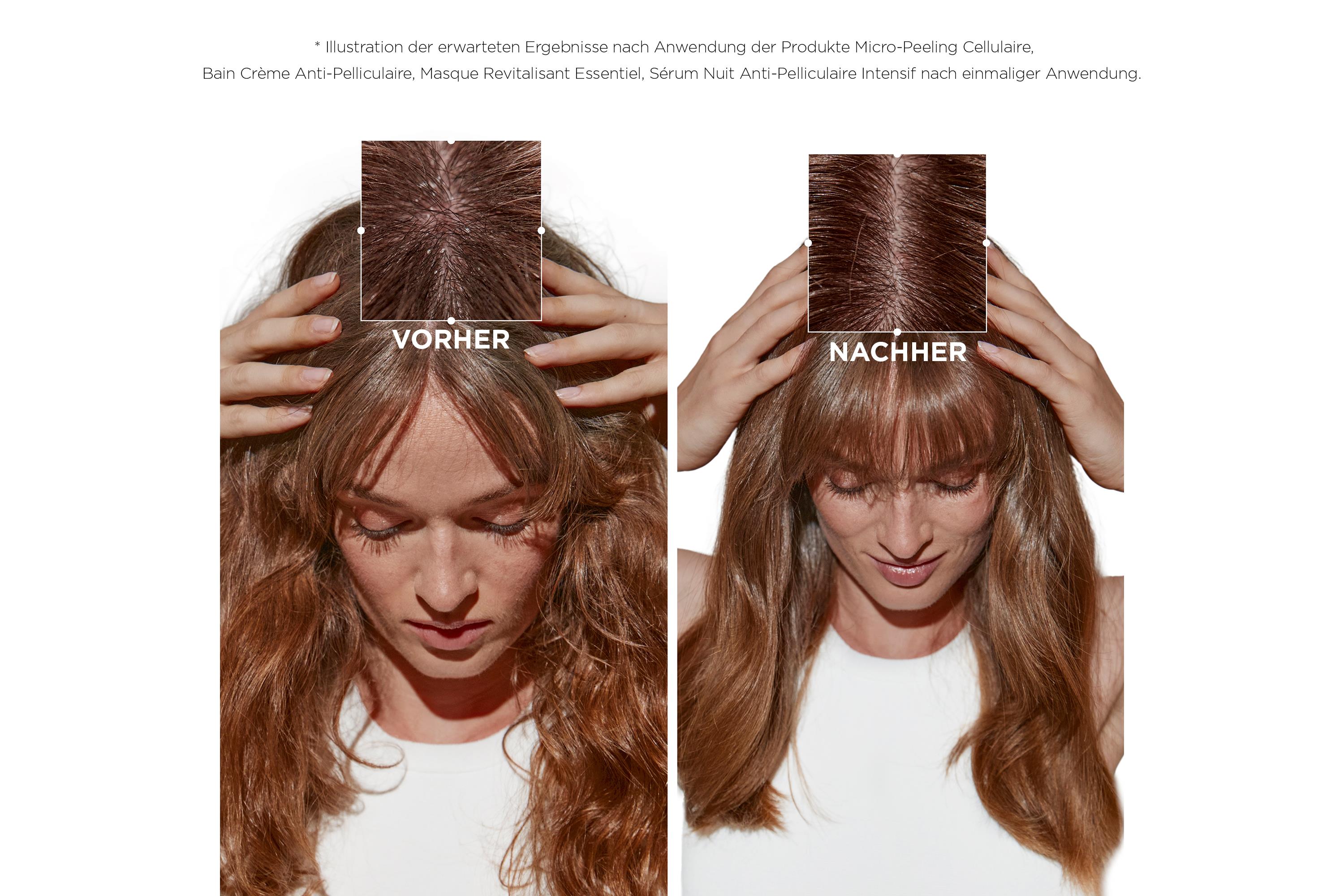 Kérastase Symbiose Micro-Peeling Cellulaire 200ml