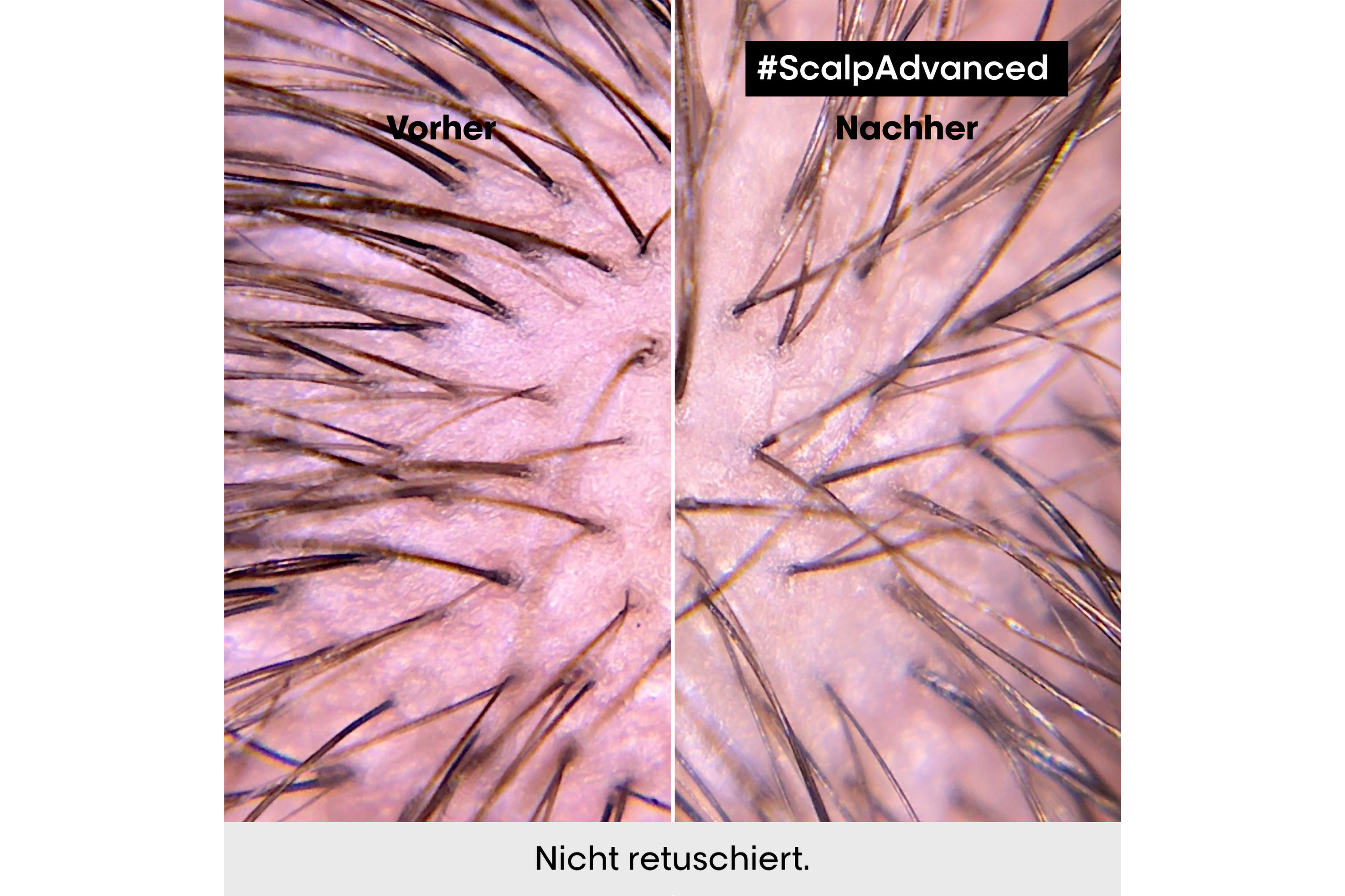 L'Oreal Serie Expert Scalp Advanced Anti-Discomfort Dermo-Regulator Shampoo 1500ml