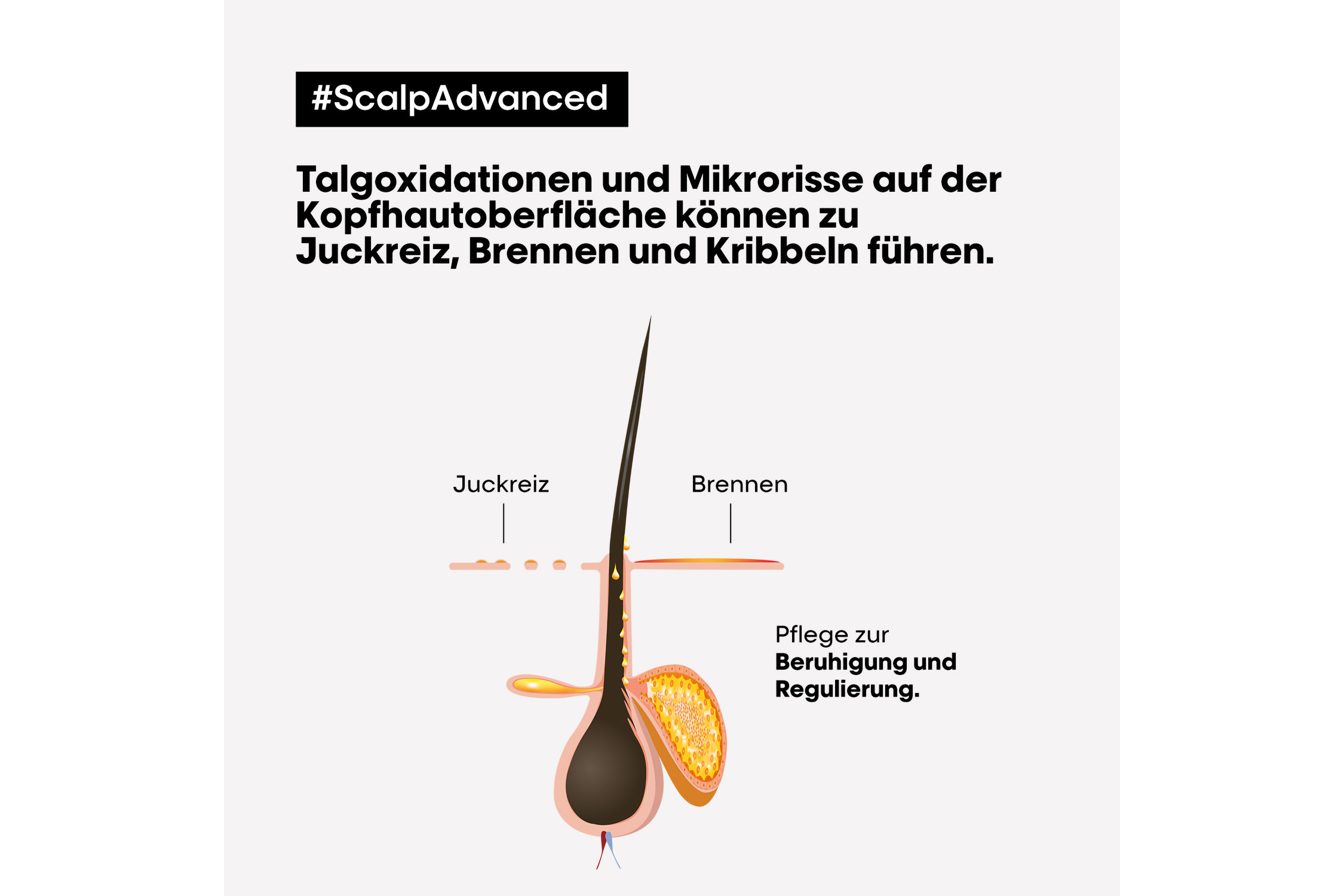 L'Oreal Serie Expert Scalp Advanced Anti-Discomfort Dermo-Regulator Shampoo 1500ml